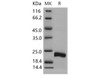 Mouse CSRP1 Recombinant Protein (His Tag) (RPES1441)