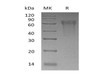 Human CLM-9/TREM4 Recombinant Protein (RPES1453)