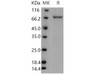 Human TPL2/MAP3K8/MEKK8 Recombinant Protein (GST Tag) (RPES1456)