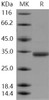 Human CMA1/Chymase 1 Recombinant Protein (RPES1458)