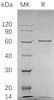 Human BLK Recombinant Protein (GST Tag) (Active) (RPES1476)