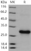 Human CLEC4A/DCIR Recombinant Protein (His Tag) (RPES1477)