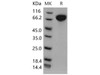 Mouse c-kit/CD117 Recombinant Protein (His Tag) (Active) (RPES1481)
