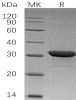 Human IMP1/IMPA1 Recombinant Protein (RPES1485)