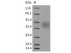 Mouse EPCR Recombinant Protein (His Tag) (RPES1488)