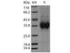 Mouse CD159a/KLRC1 Recombinant Protein (His Tag) (RPES1507)
