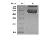 Human CDCP1/CD318 Recombinant Protein (RPES1511)