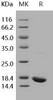 Human IL beta/IL1B Recombinant Protein (Active) (RPES1518)