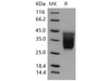 Mouse CD99L2 Recombinant Protein (His Tag) (Active) (RPES1520)