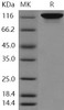 Human Autotaxin/ENPP2 Recombinant Protein (RPES1521)