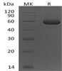 Human Peptidase D/PEPD Recombinant Protein (RPES1525)