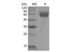 Mouse IL1R1/CD121a Recombinant Protein (RPES1533)