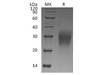 Human Interleukin-22/IL-22 Recombinant Protein (RPES1551)