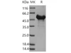 Human RTN4/NOGO-A Recombinant Protein (GST Tag) (Active) (RPES1554)