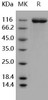 Human FLT1 Recombinant Protein (RPES1557)