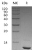 Human IGF/IGF1 Recombinant Protein (Active) (RPES1563)