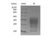 Mouse Interleukin3/IL3 Recombinant Protein (RPES1567)
