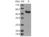 Human IRAK4/IRAK-4 Recombinant Protein (RPES1573)