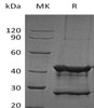 Human UBE2D1 Recombinant Protein (RPES1575)