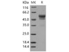 Mouse CD99/PILR1 Recombinant Protein (Fc Tag) (RPES1579)