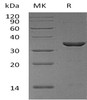 Human Cyclophilin E/PPIE Recombinant Protein (RPES1581)