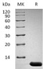 Mouse Interleukin3/IL3 Recombinant Protein (RPES1586)
