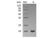 Interleukin-2/IL-2 Recombinant Protein (C145S) (RPES1590)