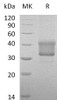 Human TNFRSF1B/CD120b Recombinant Protein (RPES1604)