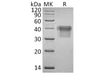 Human IL2Ra/CD25 Recombinant Protein (RPES1611)