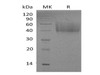 Mouse ICOS Ligand/ICOSL Recombinant Protein (RPES1612)