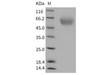 Rat TIM1/HACVR1 Recombinant Protein (His Tag) (RPES1616)