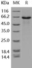 Human PCSK1/NEC1 Recombinant Protein (RPES1635)