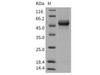 Rat GPT2 Recombinant Protein (His Tag) (RPES1636)