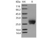 Mouse CTLA4/CD152 Recombinant Protein (RPES1637)