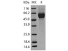 Mouse IL1R1/CD121a Recombinant Protein (His Tag) (Active) (RPES1644)
