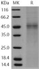 Human TPST1 Recombinant Protein (His Tag) (RPES1659)