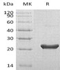 Human RPS7 Recombinant Protein (RPES1660)