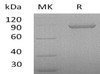 Human Periostin/OSF-2 Recombinant Protein (RPES1663)