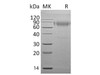 Mouse IL18BP Recombinant Protein (RPES1666)