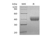 Human Mesothelin/MSLN Recombinant Protein (RPES1670)