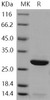 Human Peroxiredoxin 6/PRDX6 Recombinant Protein (His Tag) (RPES1679)