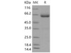 Mouse B7-DC/PD-L2/CD273 Recombinant Protein (RPES1685)