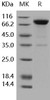 Human IL1R1/CD121a Recombinant Protein (Fc Tag) (Active) (RPES1697)
