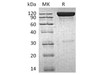 Human ICAM/CD54 Recombinant Protein (RPES1702)