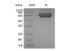 Human IL1RL1/ST2 Recombinant Protein (RPES1749)
