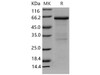Mouse MMP8/CLG1 Recombinant Protein (RPES1758)