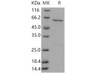 Human CSNK1A1/CKI-alpha/CK1 Recombinant Protein (GST Tag) (Active) (RPES1772)