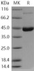 Human ENTPD5 Recombinant Protein (RPES1778)