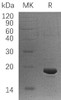 Human LSM1 Recombinant Protein (RPES1804)