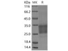 Mouse CD69 Recombinant Protein (His tag, ECD) (RPES1805)